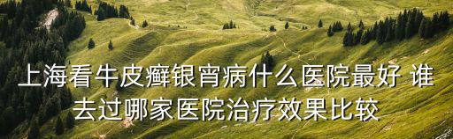 上海看牛皮癬銀宵病什么醫院最好 誰去過哪家醫院治療效果比較