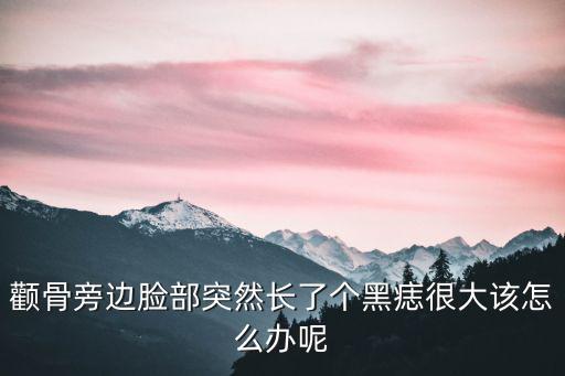 顴骨有痣，右側顴骨上有痣是什么含義