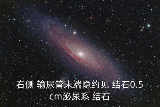 輸尿管結石怎么引起的,尿路結石可通過沖擊波碎石