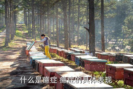癔癥癥狀，癔癥是什么病