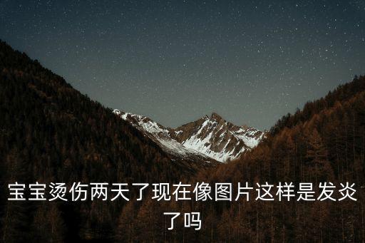 寶寶燙傷兩天了現(xiàn)在像圖片這樣是發(fā)炎了嗎