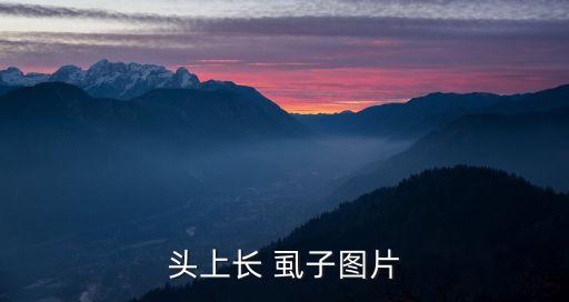 頭虱子圖片,長發虱子怎么來的?看看這里!