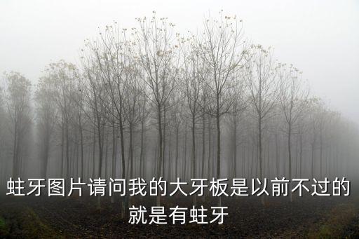 蛀牙圖片請問我的大牙板是以前不過的就是有蛀牙
